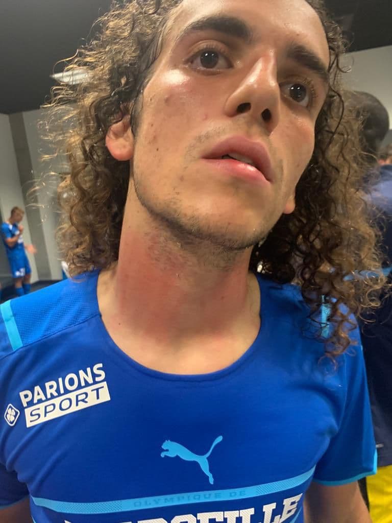 Трое футболистов Марселя были ранены после нападения фанатов Ниццы
